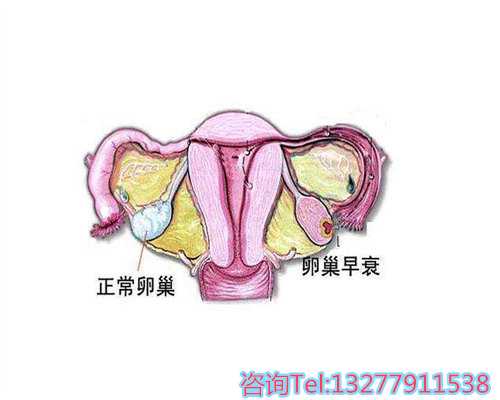 厦门什么地方供卵快点,需要多大的年龄才能进行