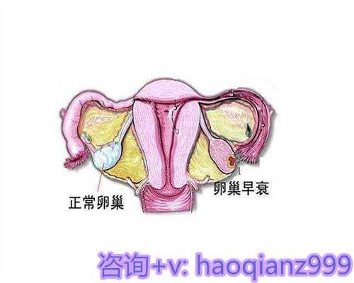 代孕咨询机构,宫腔镜诊断性刮宫疼吗