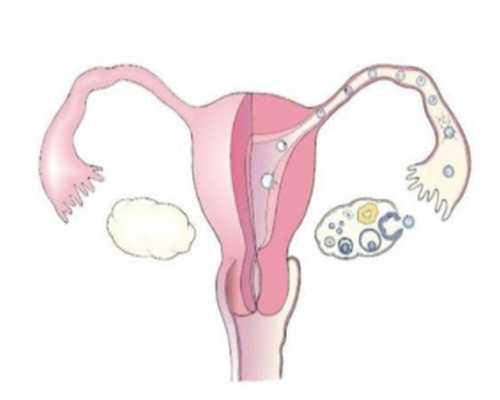 厦门代怀公司供卵为生命的奇迹献一份真情