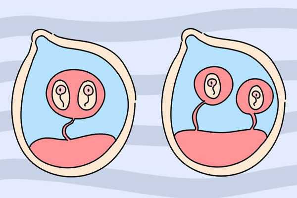 试管代生多少钱明细表,同卵双胞胎和异卵双胞胎的区别，专家科普双胞胎的秘